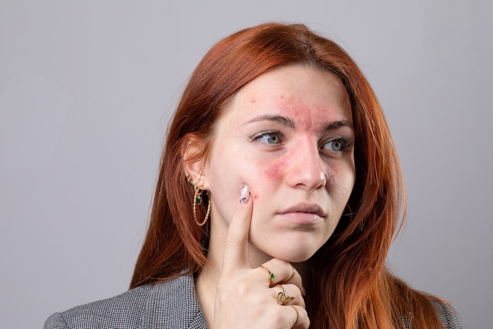 Johns Creek compounded skin care medication.